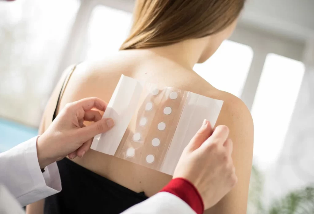 A female test subject is getting the sample patches applied to the back of her shoulder.